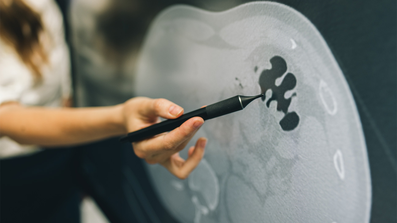 A close-up of an individual applying a touchscreen pen on a monitor with medical imaging on it.